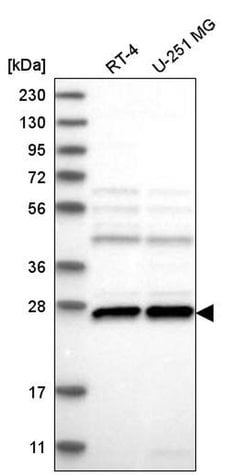 Invitrogen C1orf216 Polyclonal Antibody 100 &mu;L; Unconjugated:Antibodies,