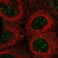UBXD5 Polyclonal Antibody:Antibodies, Polyclonal