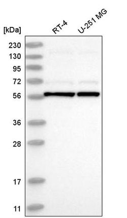 UBXD5 Polyclonal Antibody:Antibodies, Polyclonal