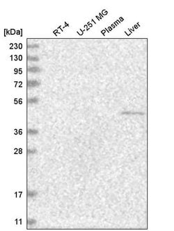 Invitrogen GCNF Polyclonal Antibody 100 &mu;L; Unconjugated:Antibodies,