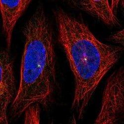 Invitrogen Jouberin Polyclonal Antibody 100 μL; Unconjugated:Antibodies,