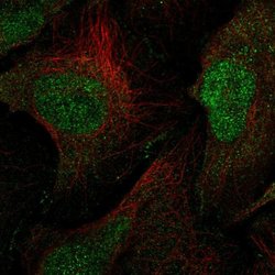Invitrogen MAGI1 Polyclonal Antibody 100 &mu;L; Unconjugated:Antibodies,