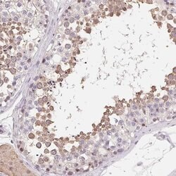 Invitrogen LCA5L Polyclonal Antibody 100 &mu;L; Unconjugated:Antibodies,
