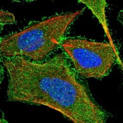 KIAA1522 Polyclonal Antibody:Antibodies, Polyclonal
