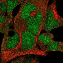 Invitrogen FBXO7 Polyclonal Antibody 100 &mu;L; Unconjugated:Antibodies,