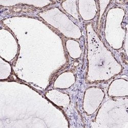 Invitrogen MYO5C Polyclonal Antibody 100 &mu;L | Buy Online | Invitrogen&trade; | Fisher Scientific