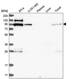 Invitrogen EXOC6B Polyclonal Antibody 100 &mu;L; Unconjugated:Antibodies,