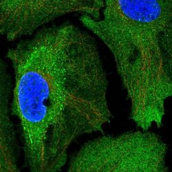 Invitrogen SSFA2 Polyclonal Antibody 100 &mu;L; Unconjugated:Antibodies,