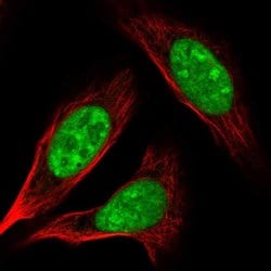 Invitrogen AK6 Polyclonal Antibody 100 &mu;L; Unconjugated:Antibodies,
