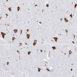 Invitrogen PACT Polyclonal Antibody 100 &mu;L | Buy Online | Invitrogen&trade; | Fisher Scientific