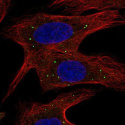 Invitrogen ABCB9 Polyclonal Antibody 100 &mu;L; Unconjugated:Antibodies,