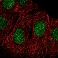 ZRANB3 Polyclonal Antibody:Antibodies, Polyclonal