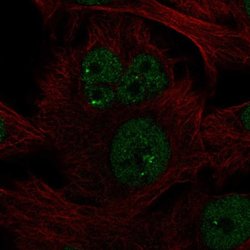 Invitrogen NME5 Polyclonal Antibody 100 &mu;L; Unconjugated:Antibodies,