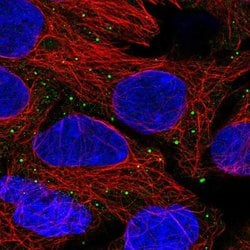 Invitrogen ANKRD6 Polyclonal Antibody 100 &mu;L | Buy Online | Invitrogen&trade; | Fisher Scientific