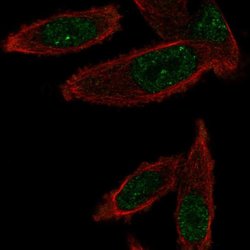 Invitrogen Gemin 6 Polyclonal Antibody 100 &mu;L; Unconjugated:Antibodies,