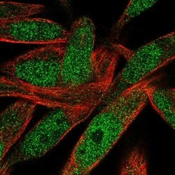 Invitrogen POLN Polyclonal Antibody 100 &mu;L | Buy Online | Invitrogen&trade; | Fisher Scientific