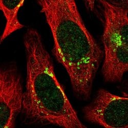 Invitrogen RNPEP Polyclonal Antibody 100 μL; Unconjugated:Antibodies,