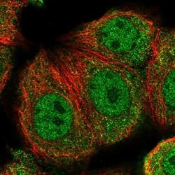 TXNRD3 Polyclonal Antibody:Antibodies, Polyclonal