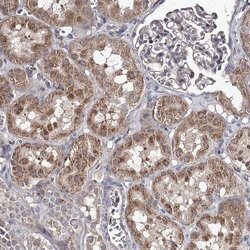 Invitrogen RASSF6 Polyclonal Antibody 100 &mu;L; Unconjugated:Anticuerpos