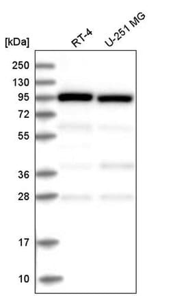Invitrogen COPG Polyclonal Antibody 100 &mu;L; Unconjugated:Antibodies,