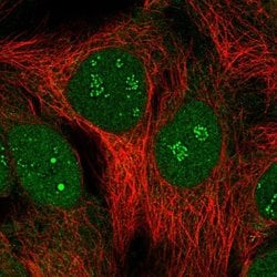 Invitrogen SIMC1 Polyclonal Antibody 100 &mu;L; Unconjugated:Antibodies,