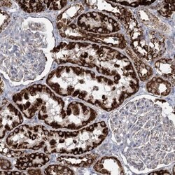 Invitrogen DHTKD1 Polyclonal Antibody 100 &mu;L; Unconjugated:Antibodies,