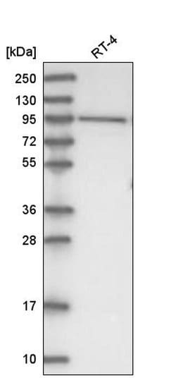 Invitrogen DHTKD1 Polyclonal Antibody 100 &mu;L; Unconjugated:Antibodies,