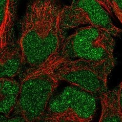Invitrogen BCCIP Polyclonal Antibody 100 &mu;L; Unconjugated:Antibodies,