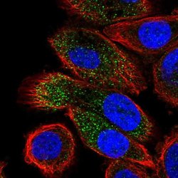 Invitrogen ABHD14A Polyclonal Antibody 100 &mu;L; Unconjugated:Antibodies,