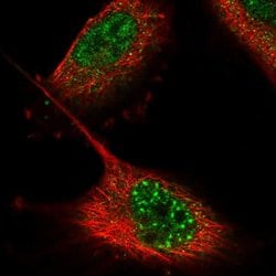Invitrogen ZNF551 Polyclonal Antibody 100 &mu;L; Unconjugated:Antibodies,