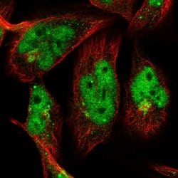 OTUD1 Polyclonal Antibody:Antibodies, Polyclonal