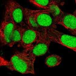 Invitrogen KIN Polyclonal Antibody 100 &mu;L; Unconjugated:Antibodies,