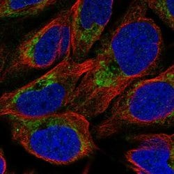 Invitrogen NMNAT3 Polyclonal Antibody 100 &mu;L; Unconjugated:Anticuerpos