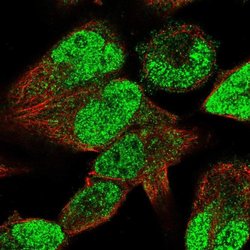 Invitrogen STAC3 Polyclonal Antibody 100 &mu;L; Unconjugated:Antibodies,