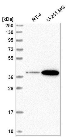 Invitrogen SPPL2B Polyclonal Antibody 100 &mu;L | Buy Online | Invitrogen&trade; | Fisher Scientific