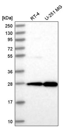 Invitrogen EMG1 Polyclonal Antibody 100 &mu;L; Unconjugated:Antibodies,