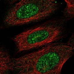 Invitrogen PRR13 Polyclonal Antibody 100 &mu;L; Unconjugated:Antibodies,