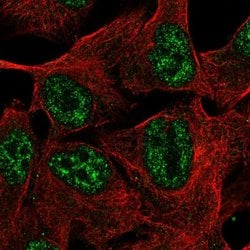 Invitrogen TMEM101 Polyclonal Antibody 100 &mu;L; Unconjugated:Antibodies,