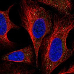 Invitrogen DNAJC22 Polyclonal Antibody 100 &mu;L; Unconjugated:Antibodies,