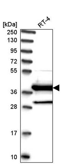 Invitrogen DNAJC22 Polyclonal Antibody 100 &mu;L; Unconjugated:Antibodies,