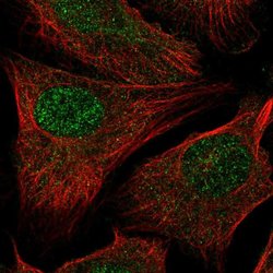 Invitrogen RAD54L2 Polyclonal Antibody 100 &mu;L; Unconjugated:Antibodies,