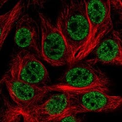 Invitrogen HOXD1 Polyclonal Antibody 100 &mu;L; Unconjugated:Antibodies,