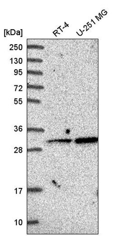 Invitrogen GLYAT Polyclonal Antibody 100 &mu;L | Buy Online | Invitrogen&trade; | Fisher Scientific