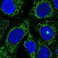 Invitrogen TMLHE Polyclonal Antibody 100 &mu;L; Unconjugated:Antibodies,