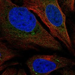 Invitrogen TMEM66 Polyclonal Antibody 100 &mu;L; Unconjugated:Antibodies,