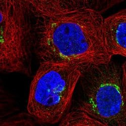 Invitrogen GLB1 Polyclonal Antibody 100 &mu;L; Unconjugated:Antibodies,