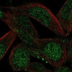 Invitrogen Ccdc89 Polyclonal Antibody 100 &mu;L; Unconjugated:Antibodies,