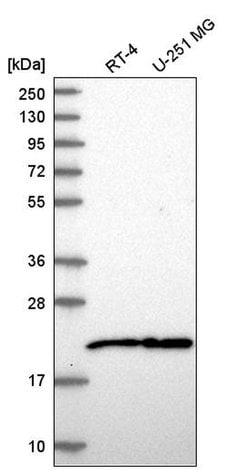 Invitrogen NIP7 Polyclonal Antibody 100 &mu;L; Unconjugated:Antibodies,