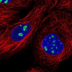 Invitrogen DDX18 Polyclonal Antibody 100 &mu;L; Unconjugated:Antibodies,