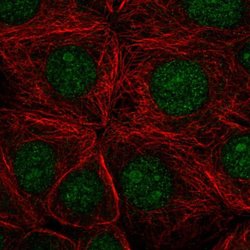 Invitrogen SF3B3 Polyclonal Antibody 100 &mu;L; Unconjugated:Antibodies,